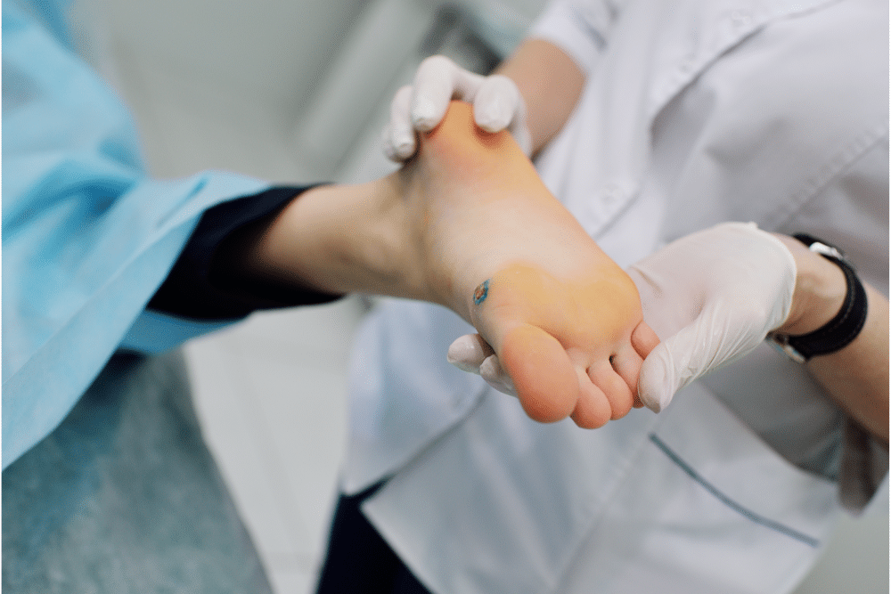 plantar warts removal